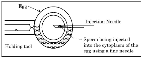 [Diagram of Egg with Injection Needle and Holding Tool]