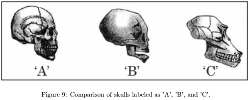 Comparison of skulls